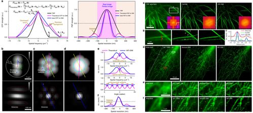 蘇州醫(yī)工所結(jié)構(gòu)光照明超分辨顯微成像技術(shù)研究取得系列進(jìn)展